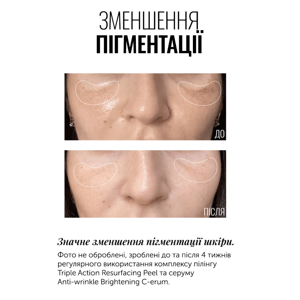 INSTYTUTUM ANTI-WRINKLE BRIGHTENING C-ERUM СУПЕРКОНЦЕНТРОВАНИЙ СЕРУМ З ВІТАМІНОМ С - фото №3 INSTYTUTUM ANTI-WRINKLE BRIGHTENING C-ERUM СУПЕРКОНЦЕНТРОВАНИЙ СЕРУМ З ВІТАМІНОМ С - фото №3